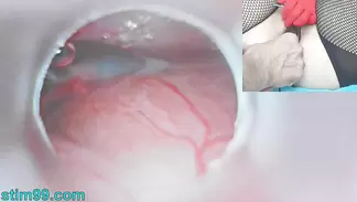 Beautiful Cervix Porn - Cervix Porn Videos